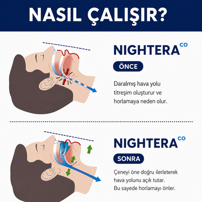 NIGHTERAᶜᵒ Horlama Önleyici Ağızlık